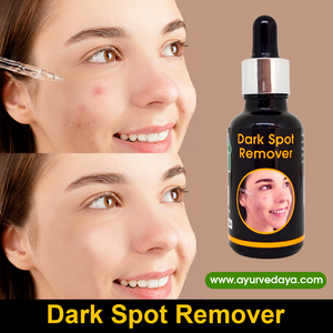 Dark Spot Remover